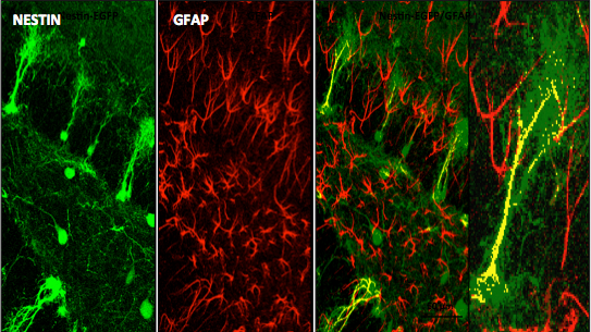 Co-localization of Nestin and GFAP in the DG of Nestin-EGFP Transgenic Reporter Mice